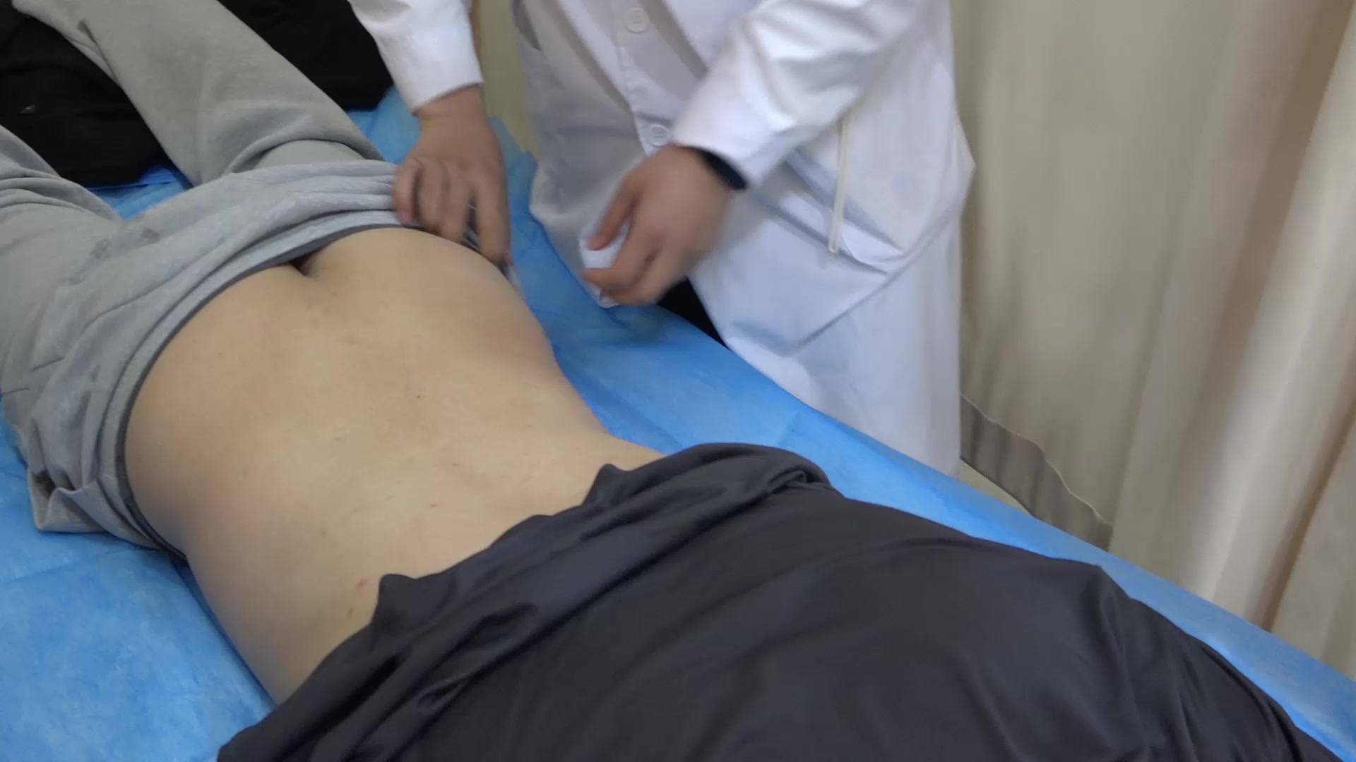 劳损筋伤：40岁男性锻炼后脊柱不适的针刺痛点拔罐法