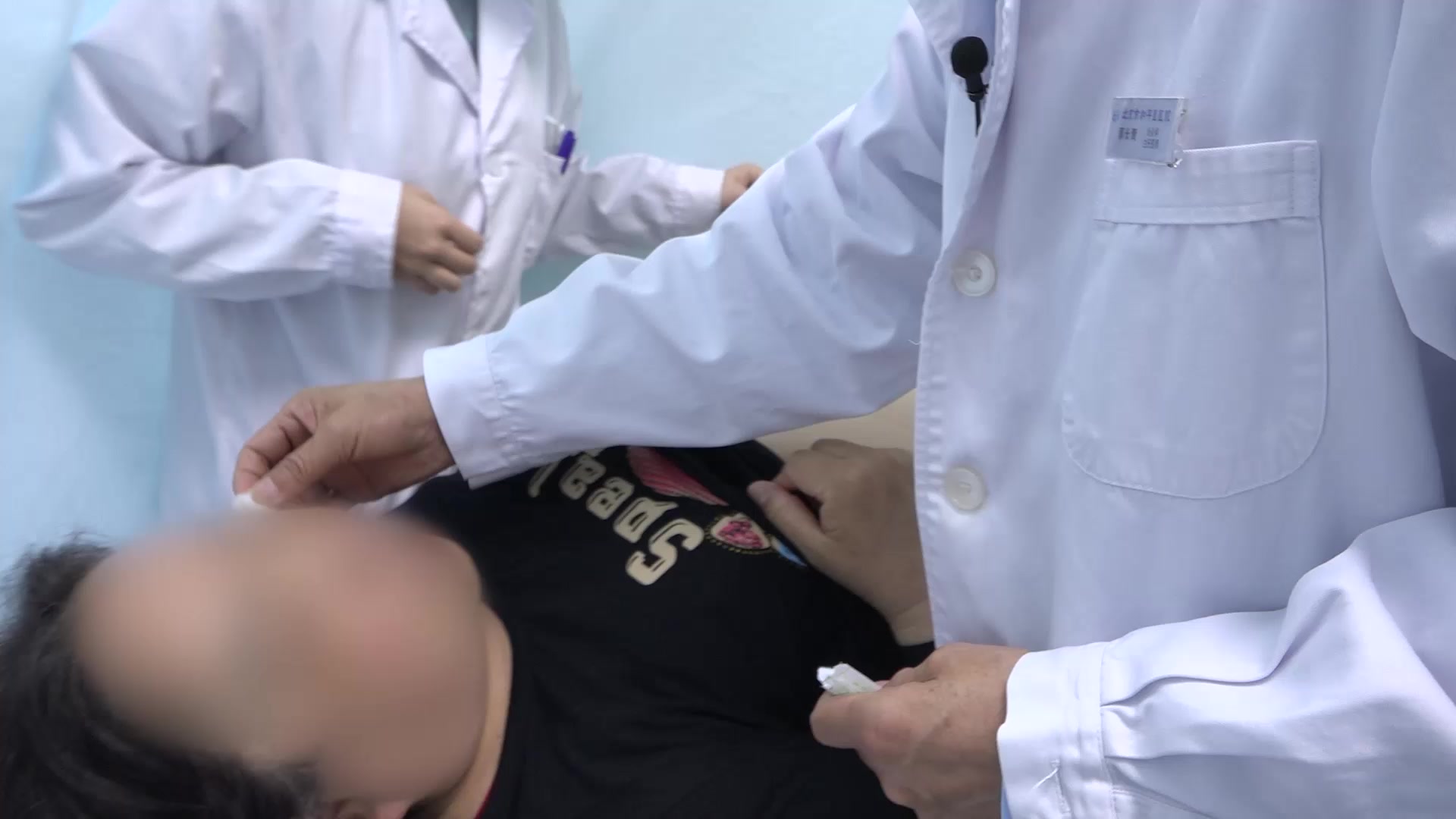面瘫后遗症：60岁女性面瘫后遗症的针灸治疗兼减肥配穴