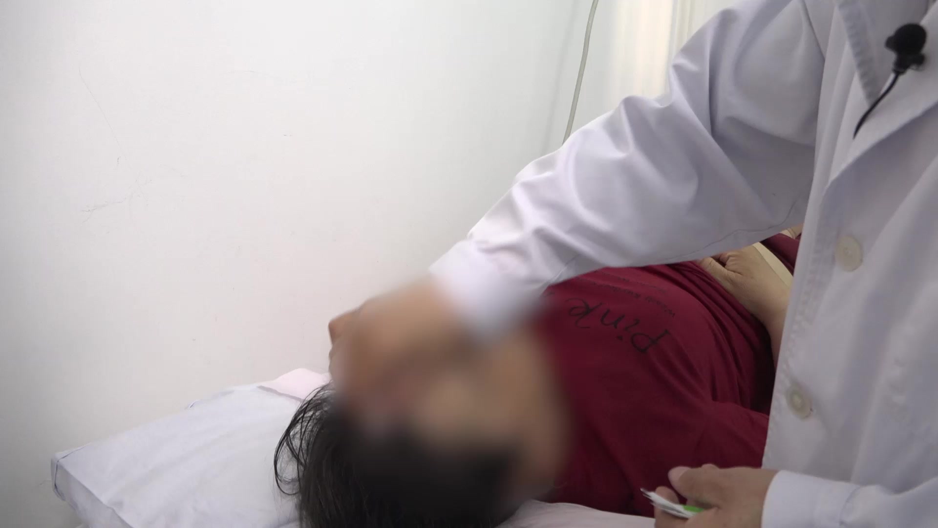 风邪阻络：45岁女性左侧面瘫伴流泪的肠俞穴针刺治疗