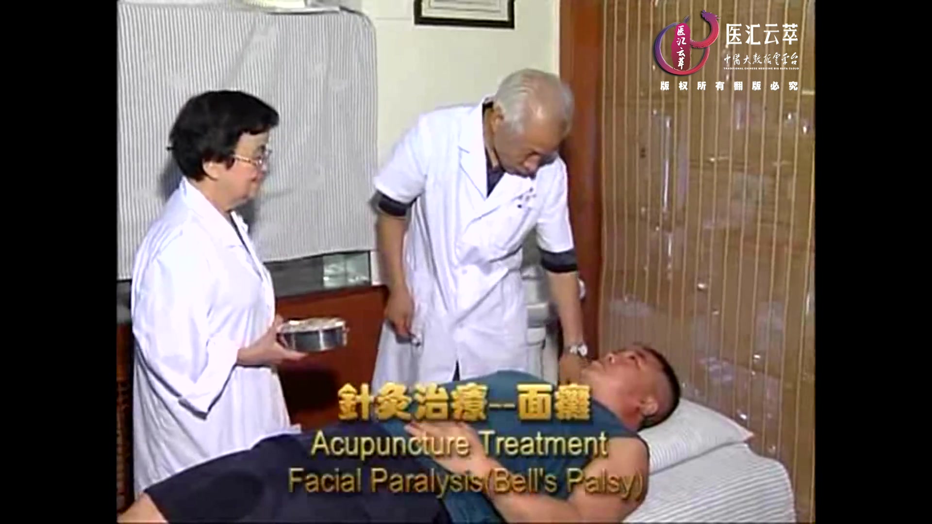 面瘫(英文)